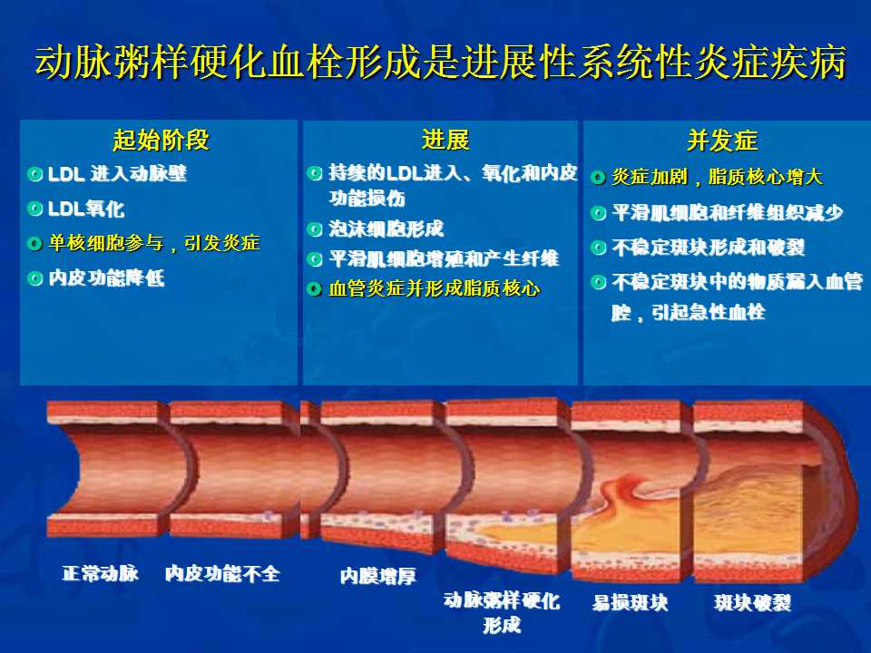 动脉粥样硬化血栓形成疾病的抗栓治疗课件血栓闭塞心血管学术资源365医学网