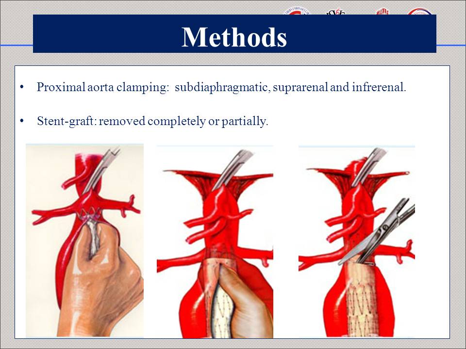 Seventeen years’ experience of late open surgical conversion after